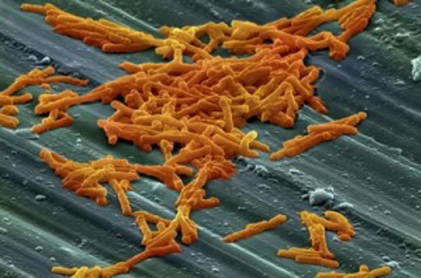 Bacteria - Clostridium Difficile