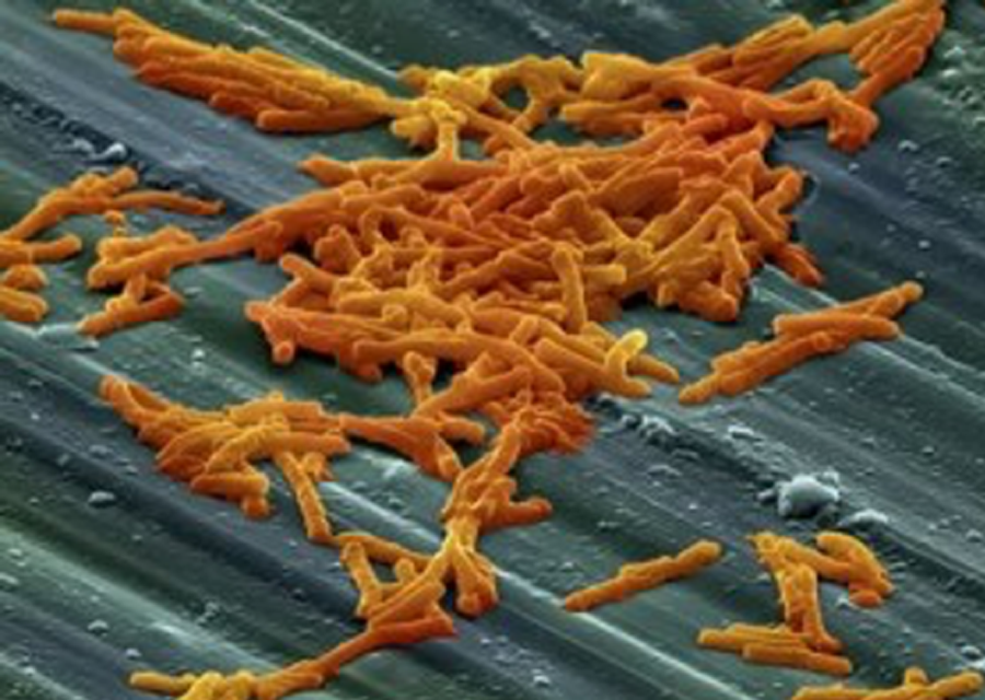 Bacteria - C. Diff. / Clostridium Difficile