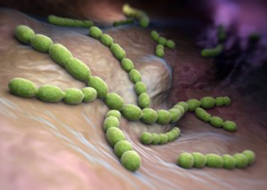 Bacteria - Streptococcus pneumoniae